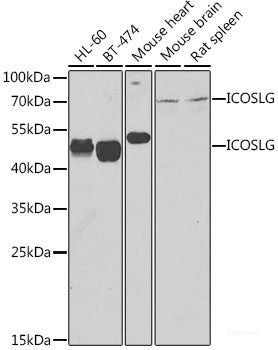 Immunofluorescence analysis of HeLa cells using TriMethyl-Histone H3-K56 Polyclonal Antibody at dilution of 1:100 (40x lens). Blue: DAPI for nuclear staining.