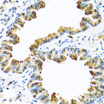 Immunohistochemistry of paraffin-embedded Human colon using NCBP2 Polyclonal Antibody at dilution of 1:200 (40x lens).