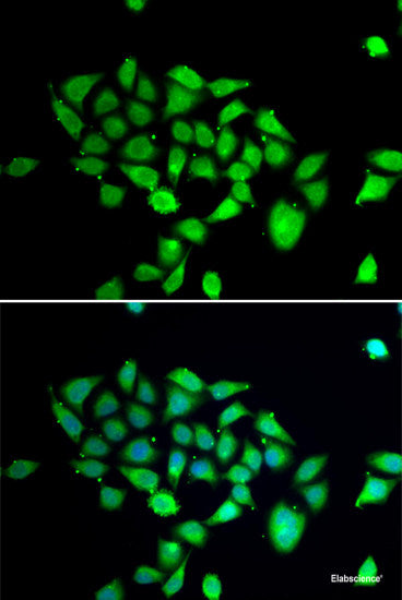 Immunohistochemistry of paraffin-embedded Human stomach using PRKAG1 Polyclonal Antibody at dilution of 1:100 (40x lens).