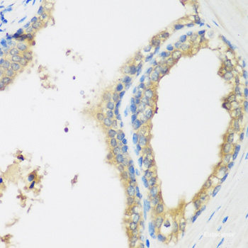 Immunohistochemistry of paraffin-embedded Rat spleen using WBSCR22 Polyclonal Antibody at dilution of 1:100 (40x lens).