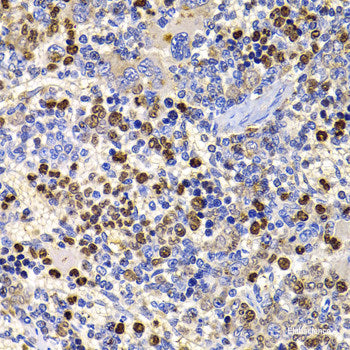 Immunohistochemistry of paraffin-embedded Rat kidney using BMP15 Polyclonal Antibody at dilution of 1:100 (40x lens).