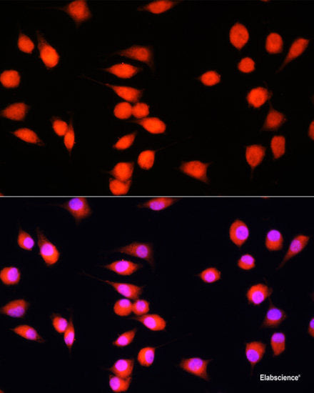Immunofluorescence analysis of U-2 OS cells using ETS2 Polyclonal Antibody at dilution of 1:100. Blue: DAPI for nuclear staining.