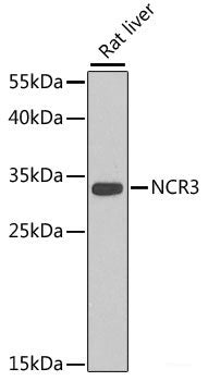 Immunofluorescence analysis of U-2 OS cells using PAX6 Polyclonal Antibody at dilution of 1:100. Blue: DAPI for nuclear staining.