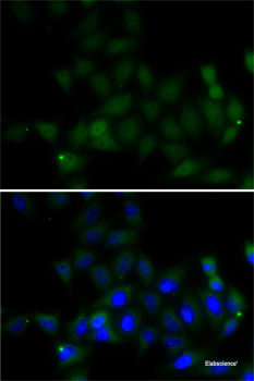 Immunohistochemistry of paraffin-embedded Human liver cancer using PON1 Polyclonal Antibody at dilution of 1:100 (40x lens).