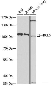 Immunohistochemistry of paraffin-embedded Human liver cancer using PTGS1 Polyclonal Antibody at dilution of 1:100 (40x lens).