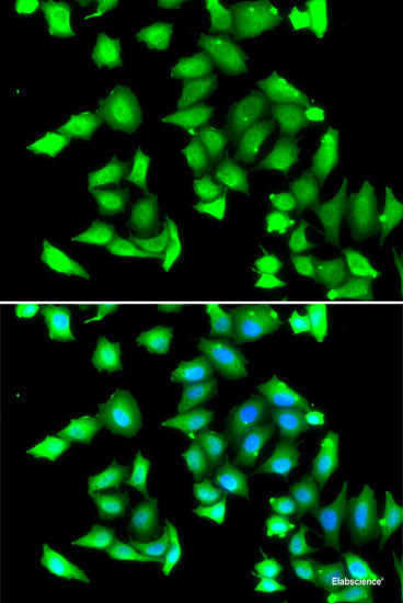 Immunohistochemistry of paraffin-embedded Human kidney using LZTR1 Polyclonal Antibody at dilution of 1:100 (40x lens).