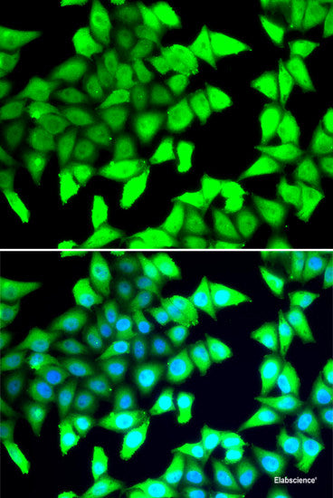 Immunohistochemistry of paraffin-embedded Rat brain using CIAO1 Polyclonal Antibody at dilution of 1:100 (40x lens).