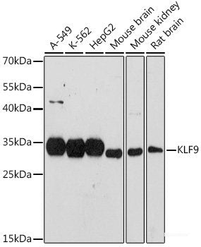 Immunohistochemistry of paraffin-embedded Human liver damage using CARD10 Polyclonal Antibody at dilution of 1:100 (40x lens).