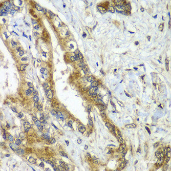 Immunohistochemistry of paraffin-embedded Mouse kidney using ERGIC2 Polyclonal Antibody at dilution of 1:100 (40x lens).