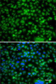 Immunohistochemistry of paraffin-embedded Human prostate using PPAN Polyclonal Antibody at dilution of 1:200 (40x lens).