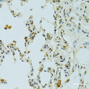 Immunohistochemistry of paraffin-embedded Rat brain using CAMK1G Polyclonal Antibody at dilution of 1:100 (40x lens).