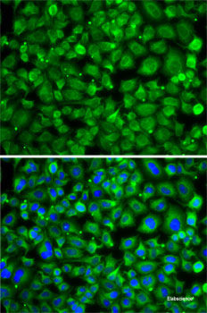 Immunohistochemistry of paraffin-embedded Human kidney using CSRP2BP Polyclonal Antibody at dilution of 1:100 (40x lens).