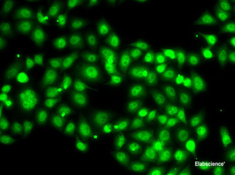 Immunohistochemistry of paraffin-embedded Mouse kidney using NLRC4 Polyclonal Antibody at dilution of 1:100 (40x lens).