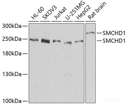 Immunohistochemistry of paraffin-embedded Rat brain using LGR6 Polyclonal Antibody at dilution of 1:100 (40x lens).