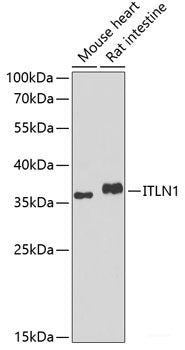 Immunohistochemistry of paraffin-embedded Human kidney using SPIN2B Polyclonal Antibody at dilution of 1:100 (40x lens).
