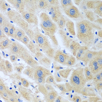 Immunohistochemistry of paraffin-embedded Rat kidney using NDUFV2 Polyclonal Antibody at dilution of 1:100 (40x lens).