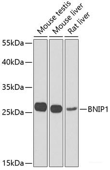 Immunohistochemistry of paraffin-embedded Rat kidney using OAZ1 Polyclonal Antibody at dilution of 1:100 (40x lens).