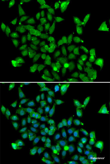 Immunofluorescence analysis of L929 cells using RAB5B Polyclonal Antibody at dilution of 1:100. Blue: DAPI for nuclear staining.