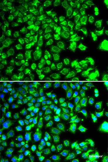 Immunohistochemistry of paraffin-embedded Human colon using TEAD3 Polyclonal Antibody at dilution of 1:100 (40x lens).