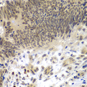 Immunohistochemistry of paraffin-embedded Rat brain using DAAM2 Polyclonal Antibody at dilution of 1:100 (40x lens).