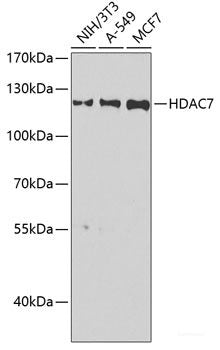 Immunohistochemistry of paraffin-embedded Mouse brain using COQ3 Polyclonal Antibody at dilution of 1:100 (40x lens).