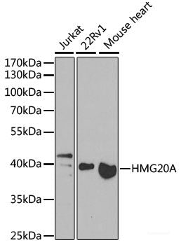 Immunohistochemistry of paraffin-embedded Human kidney using PRKAG3 Polyclonal Antibody at dilution of 1:100 (40x lens).