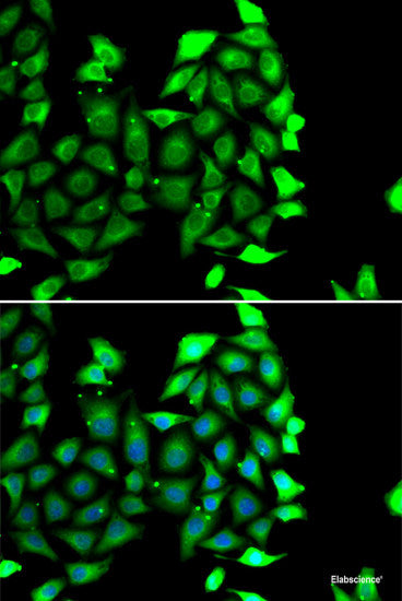 Immunohistochemistry of paraffin-embedded Rat heart using THAP1 Polyclonal Antibody at dilution of 1:100 (40x lens).