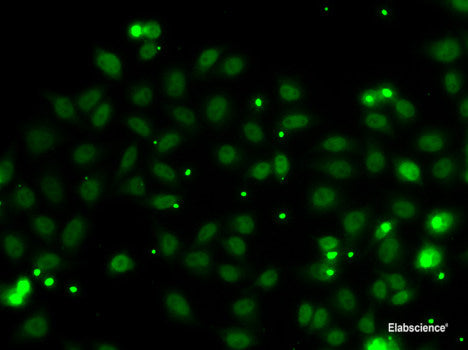 Immunohistochemistry of paraffin-embedded Rat kidney using ZFAND3 Polyclonal Antibody at dilution of 1:100 (40x lens).