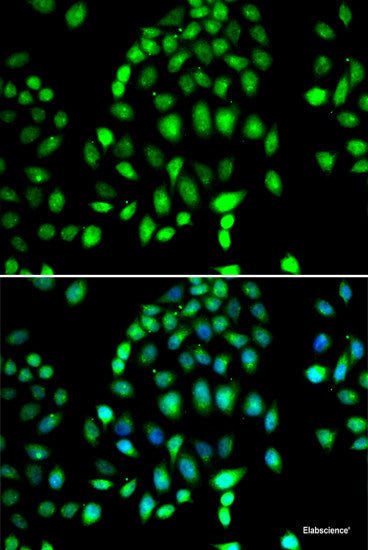 Immunohistochemistry of paraffin-embedded Rat intestine using RRAGC Polyclonal Antibody at dilution of 1:100 (40x lens).