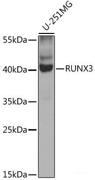 Immunohistochemistry of paraffin-embedded Human kidney cancer using ZNF169 Polyclonal Antibody at dilution of 1:100 (40x lens).
