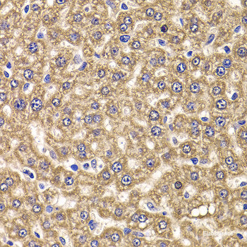 Immunohistochemistry of paraffin-embedded Rat kidney using ALDH1A2 Polyclonal Antibody at dilution of 1:100 (40x lens).