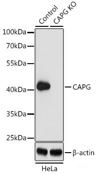 Immunohistochemistry of paraffin-embedded Human gastric using SESN2 Polyclonal Antibody at dilution of 1:100 (40x lens).