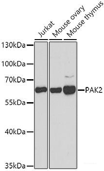 Immunohistochemistry of paraffin-embedded Rat testis using ATG14 Polyclonal Antibody at dilution of 1:100 (40x lens).