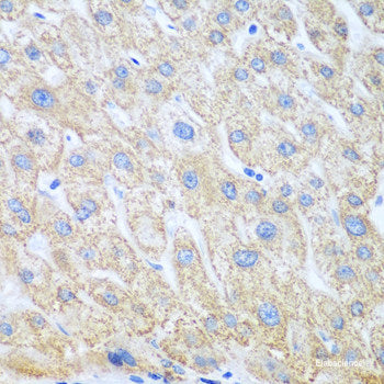 Immunohistochemistry of paraffin-embedded Rat brain using CBR3 Polyclonal Antibody at dilution of 1:100 (40x lens).