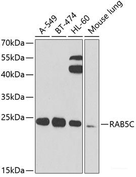 Immunohistochemistry of paraffin-embedded Rat brain using CHN1 Polyclonal Antibody at dilution of 1:100 (40x lens).