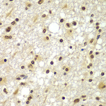 Immunohistochemistry of paraffin-embedded Mouse lung using CYP2F1 Polyclonal Antibody at dilution of 1:200 (40x lens).