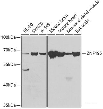 Immunohistochemistry of paraffin-embedded Rat heart using DVL2 Polyclonal Antibody at dilution of 1:100 (40x lens).