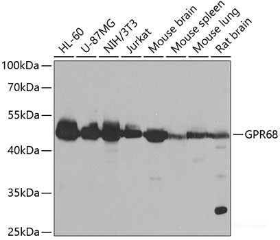 Immunohistochemistry of paraffin-embedded Human liver damage using EIF4G1 Polyclonal Antibody at dilution of 1:100 (40x lens).
