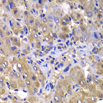 Immunohistochemistry of paraffin-embedded Human liver using CCL3 Polyclonal Antibody at dilution of 1:100 (40x lens).