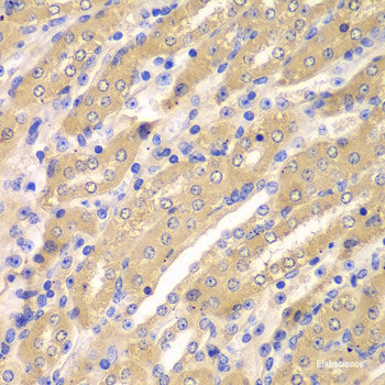 Immunohistochemistry of paraffin-embedded Human liver damage using UGT2B10 Polyclonal Antibody at dilution of 1:100 (40x lens).