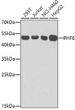 Immunofluorescence analysis of U2OS cells using CENPQ Polyclonal Antibody at dilution of 1:100. Blue: DAPI for nuclear staining.
