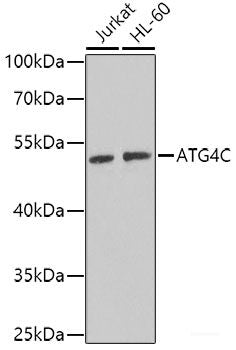 Immunohistochemistry of paraffin-embedded Human liver damage using Desmoplakin Polyclonal Antibody at dilution of 1:100 (40x lens).