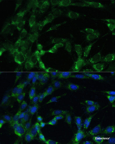 Immunohistochemistry of paraffin-embedded Human stomach using BCS1L Polyclonal Antibody at dilution of 1:100 (40x lens).