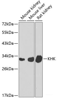 Immunohistochemistry of paraffin-embedded Rat lung using CHI3L2 Polyclonal Antibody at dilution of 1:100 (40x lens).