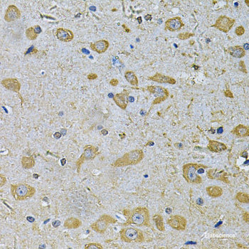 Immunofluorescence analysis of C6 cells using GSTM3 Polyclonal Antibody at dilution of 1:100. Blue: DAPI for nuclear staining.