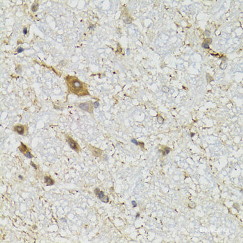 Immunofluorescence analysis of U2OS cells using HOXD10 Polyclonal Antibody at dilution of 1:100. Blue: DAPI for nuclear staining.