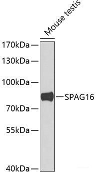 Immunofluorescence analysis of U2OS cells using NBN Polyclonal Antibody at dilution of 1:100. Blue: DAPI for nuclear staining.