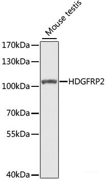 Immunohistochemistry of paraffin-embedded Rat brain using PLCG1 Polyclonal Antibody at dilution of 1:100 (40x lens).