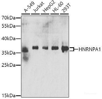 Immunohistochemistry of paraffin-embedded Human well-differentiated squamous skin carcinoma using PRKDC Polyclonal Antibody at dilution of 1:100 (40x lens).