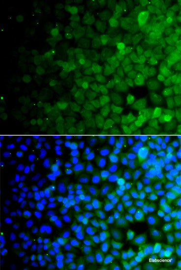 Immunohistochemistry of paraffin-embedded Rat kidney using SHC1 Polyclonal Antibody at dilution of 1:100 (40x lens).